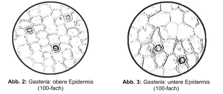 Mikroskopische Abbildungen der oberen und unteren Epidermis von Gasteria mit Spaltöffnungen.